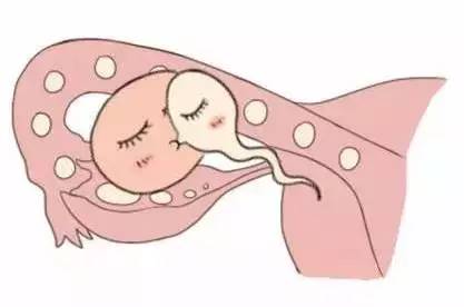 供卵代怀生子代生生男孩